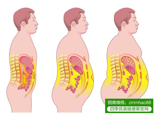 随便果深排减掉的是什么？减掉了哪些脂肪？